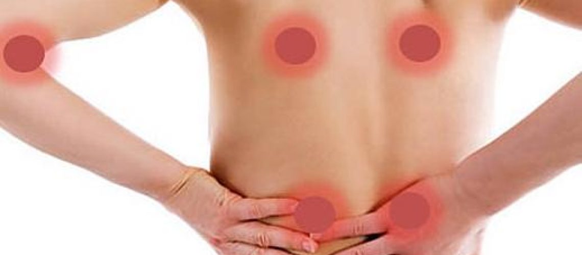 cuales_son_los_sintomas_de_la_fibromialgia_23092_600